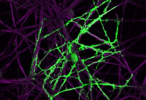 celulas-do-cerebro-4