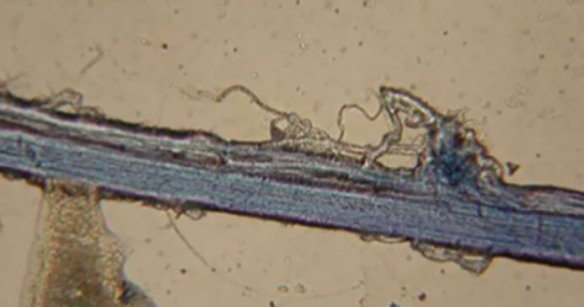 Os cientistas injectaram um corante especial que coloriu os meridianos